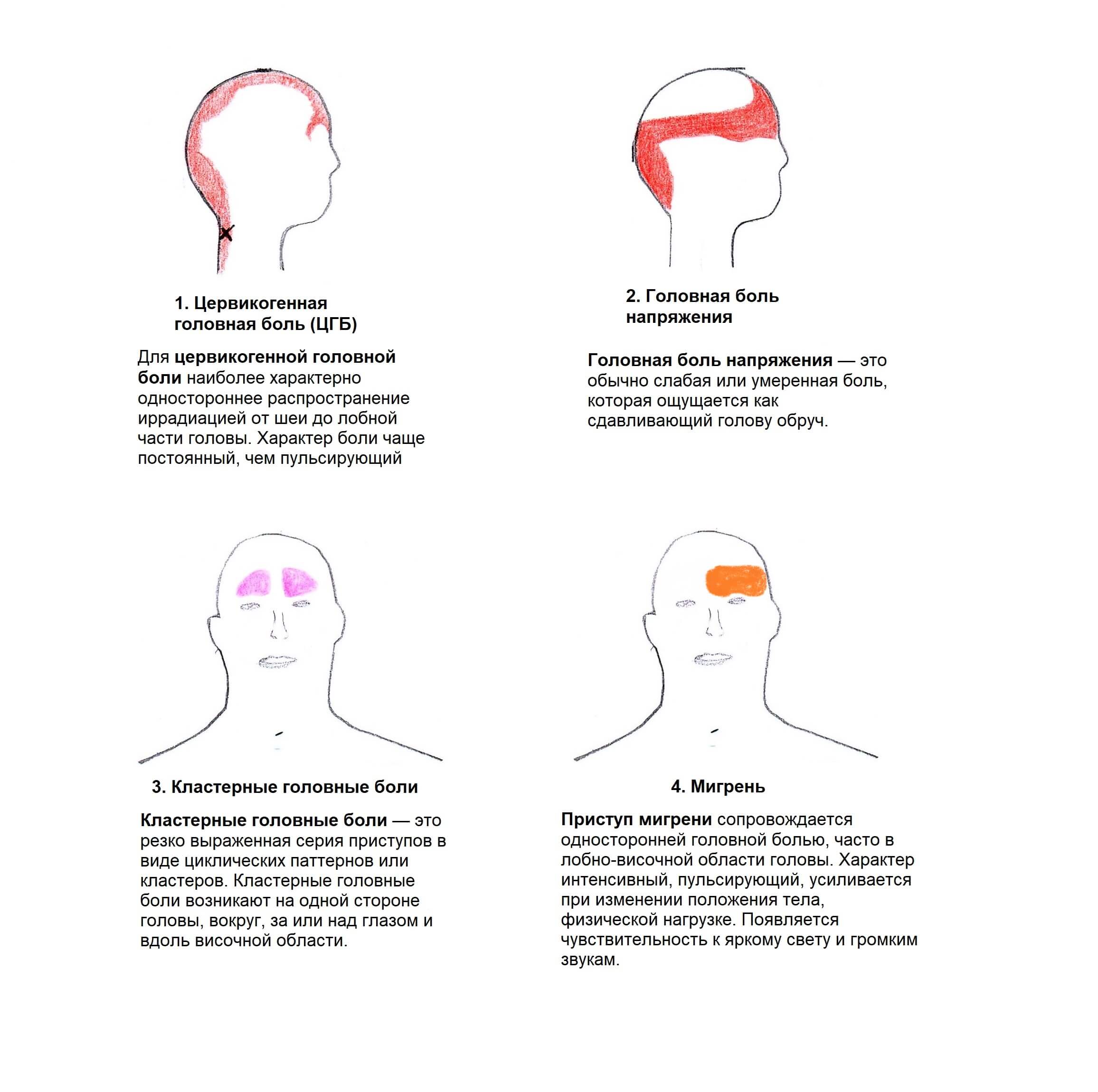 Причины ежедневной головной боли в висках и методы снятия