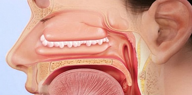 Лечение полипов в носу